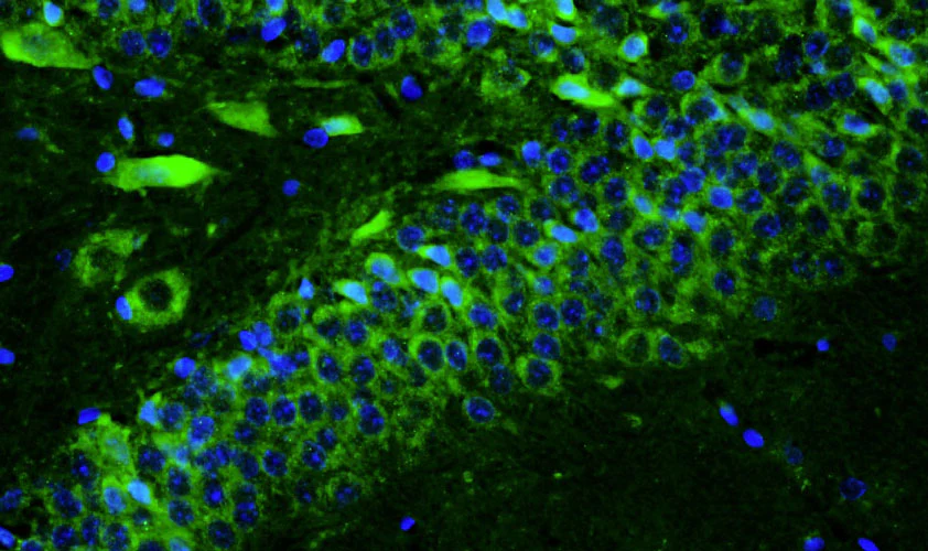 Primary Antibodies